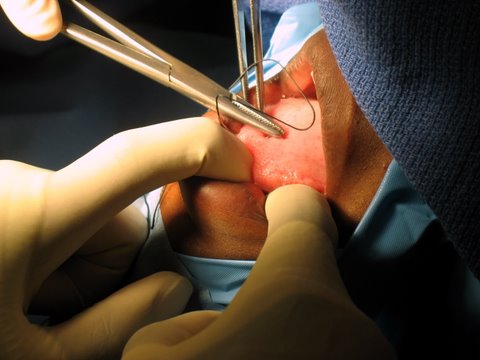 Surgery